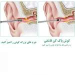مجموعه نظافت گوش مدل Ear-MK بسته 6 عددی